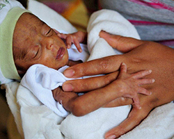 A prematurely born newborn held in an adult's hands.
