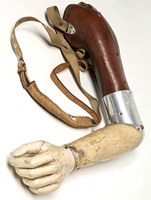 old prosthetic arm