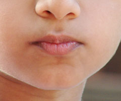 chin without cleft