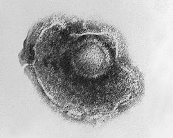 Varicella zoster, chicken pox virus.
