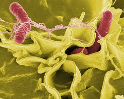 Salmonella bacteria in skin cells