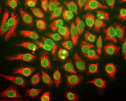 HeLa cells under a microscope