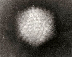 A picture from an electron microscope of an adenovirus