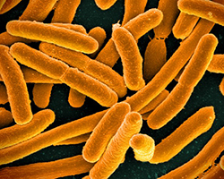 An orange colorized image of E. coli bacteria