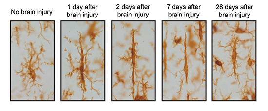 Microglia images during the days after a brain injury