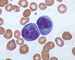 White Blood cells - monocytes