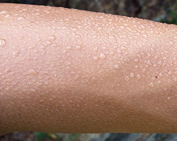 A picture of a sweaty forearm