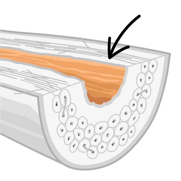 Bone Anatomy  Ask A Biologist