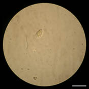 Cillate zooplankton image