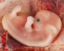 An image of a seven week old embryo from an ectopic pregnancy.