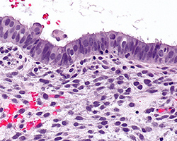 Tissue slides (histology slides) showing the endometrium