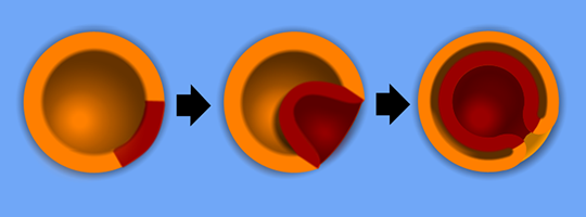 An illustration of gastrulation showing one tissue ball infold to form a second.