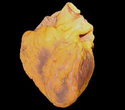 A human male heart