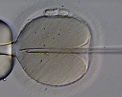 A needle puncturing a sperm cell during intracytoplasmic sperm injection