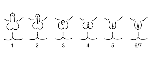 A series of illustrations showing the range of forms male, female, and intersex genitals can take.