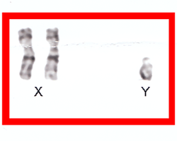 A red box outlining blurry grey figures, two of which represent the X chromosomes and one of which represents a partial Y chromosome.