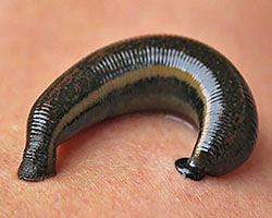 A close-up picture of a dark leech attached to a person's skin