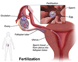 An illustration of the female reproductive system with sperm and egg moving through it