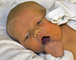 A newborn child with yellowish skin laying with its mouth open.