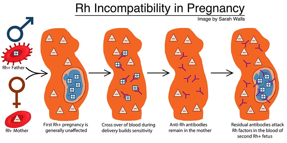 What Is Rh Factor Ask A Biologist