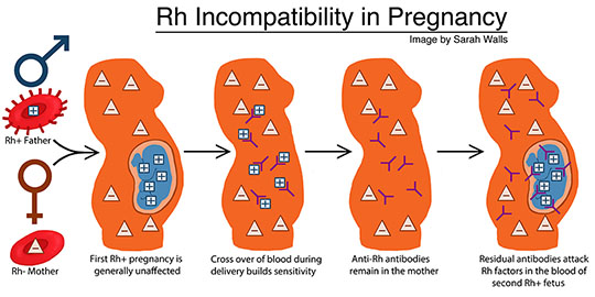 An illustration depicting how Rh Incompatibility works.