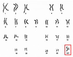 A human karyotype, showing all the different chromosomes, with a highlighted box around the sex chromosomes
