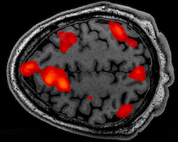 grey fMRI scan showing brain activity in red