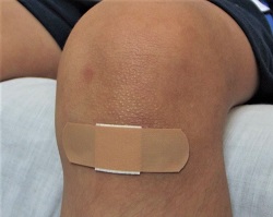 Scraped knee