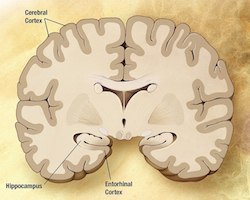 A healty brain cross-section
