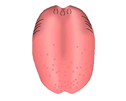 Tongue showing papillae