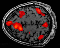 brain scan showing brain activity