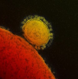 An image of a virus shown along a host cell.