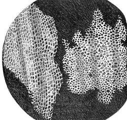 Drawing of slice of cord seen through a microscope.