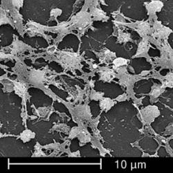 electron microscope image of  Staphylococcus aureus bacteria (CDC Image)