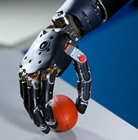 prosthetic arm