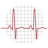 EKG