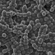 Microscopic view of Streptococcus bacteria