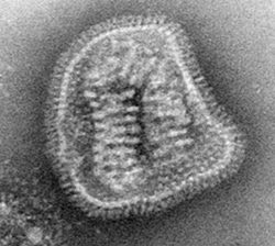 Transmission electron micrograph image of a virus.