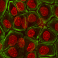Células epiteliales teñidas por Page Baluch