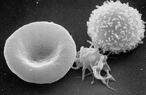 Fotografía tomada con un microscopio electrónico de barrido de una célula T (derecha), plaqueta que ayuda a que la sangre coagule (centro) y glóbulo rojo (izquierda).  Las protuberancias en la célula T son receptores usados para combatir infecciones. Del Instituto Nacional del Cáncer.