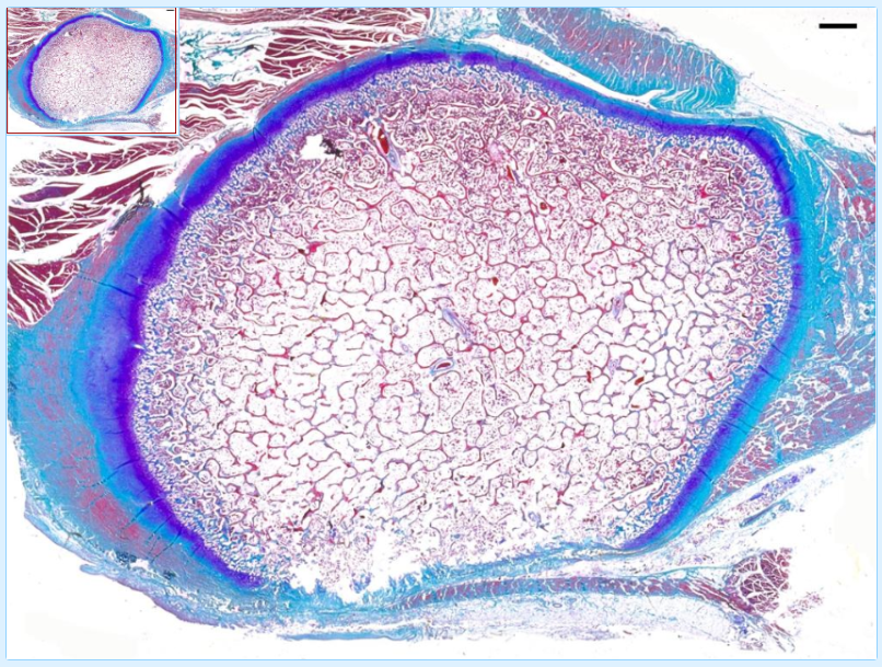 Bone histology slide
