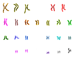Genes and chromosomes