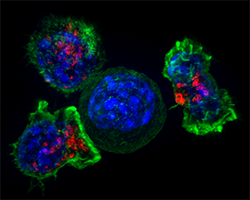 T-cells surrounding a cancer cell