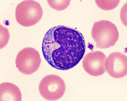 Blood slides showing red blood cells and lymphocytes