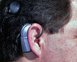 Cochlear implant