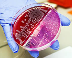 Bacteria colonies in a petri dish