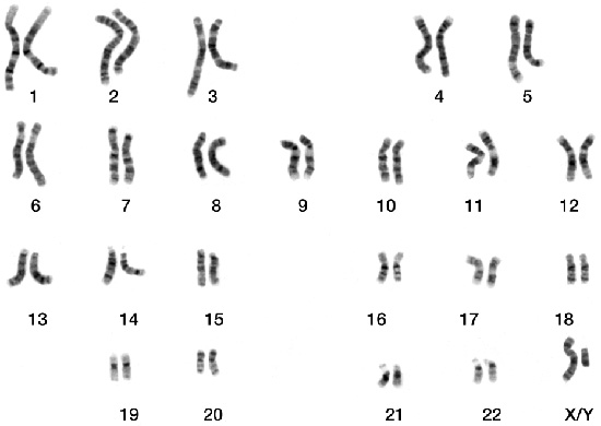 Male Human Chromosomes