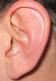 attached earlobe