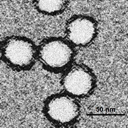 A microscope image of West nile viruses