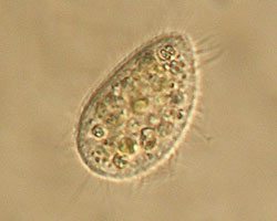 Ciliate (zooplankton)